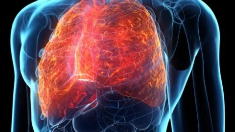 Smaller Airways in Women Account for Their Increasing Incidence of COPD
